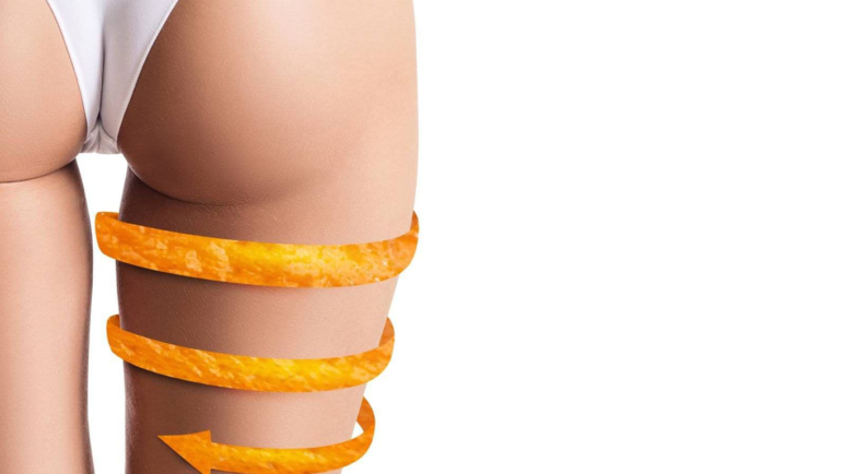 Parliamo di Cellulite?